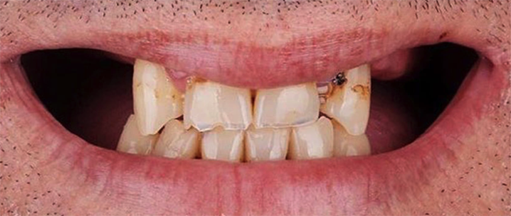 Before image